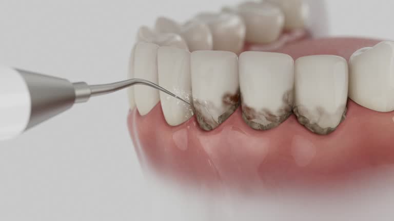 Trusted Emergency Dentist service in Rome, GA - Dentist Open Now